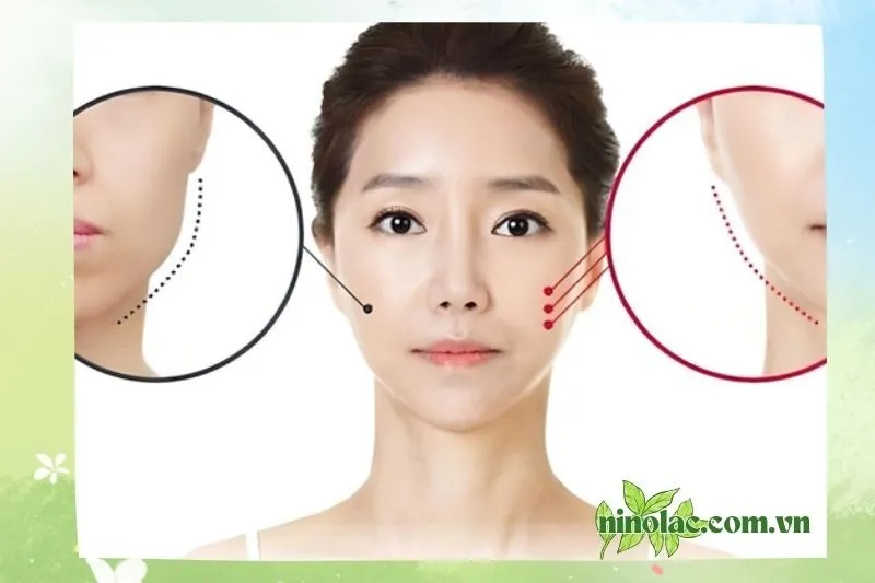 Thẩm Mỹ Quốc Tế Hoa Huệ
