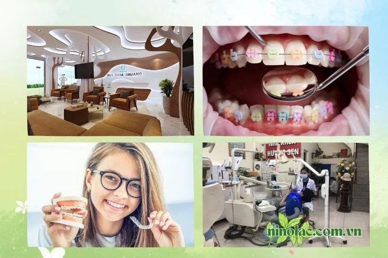 Top 10 địa chỉ niềng răng Thái Nguyên uy tín không thể bỏ qua