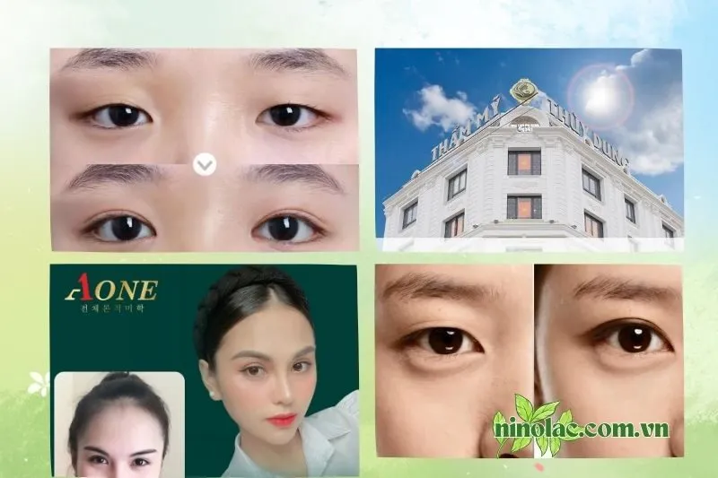Top 8 địa chỉ nhấn mí Thái Nguyên