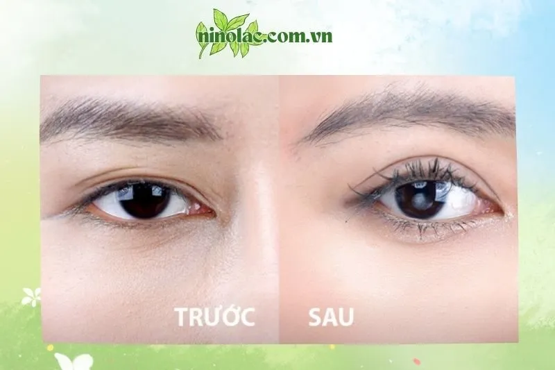 Viện Thẩm mỹ Hansoha